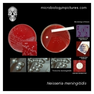 N.meningitidis